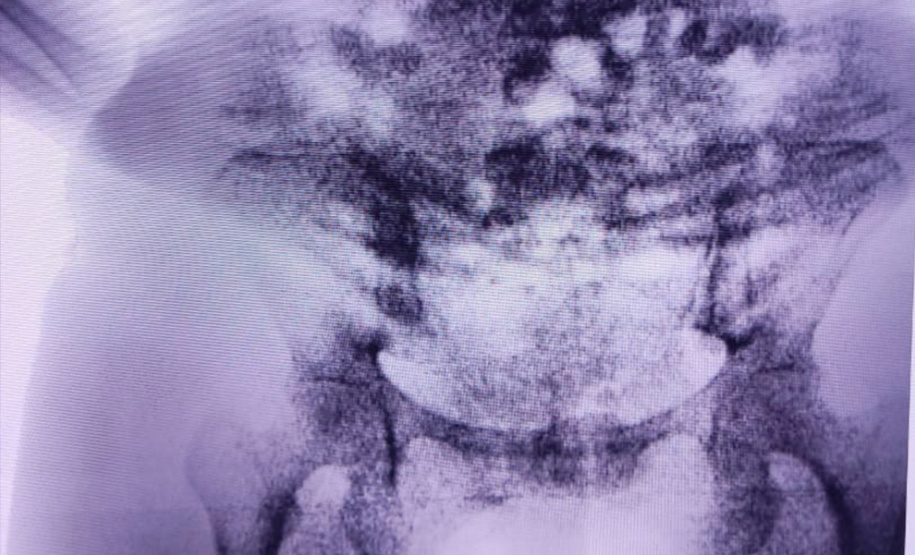 Agentes do Deppen interceptam entrada de drogas com uso do Bodycam em Foz do Iguaçu